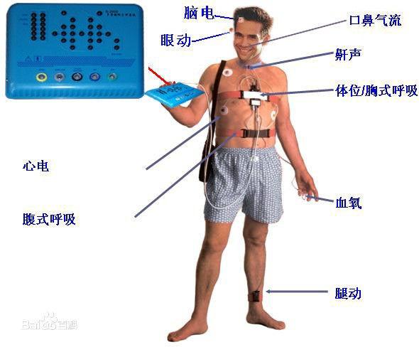 最新动态心电图仪器，引领心脏健康监测新时代